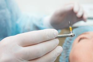 dentist placing implant on patient 