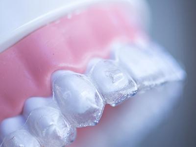 Close up of model of jaw with Invisalign clear aligner over the teeth