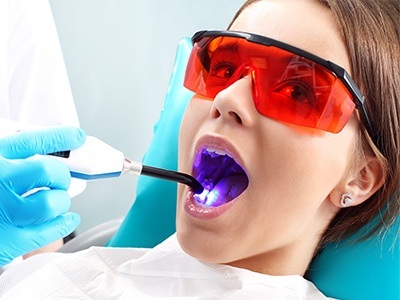 Girl getting dental sealants