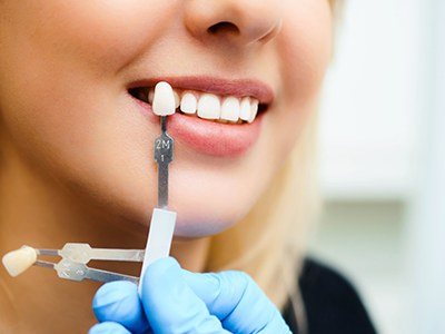 Woman getting checked for veneers