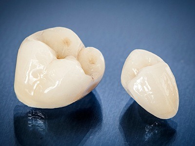 Two metal free dental crowns