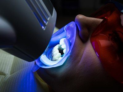 Woman getting teeth whitening in dental office