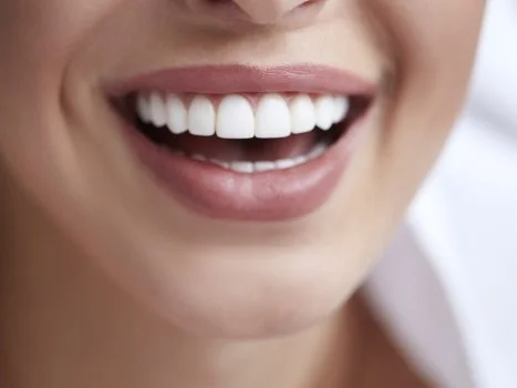Close up of person smiling with straight white teeth