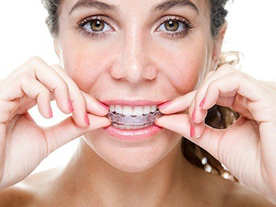 Closeup of female patient putting in her Invisalign aligners