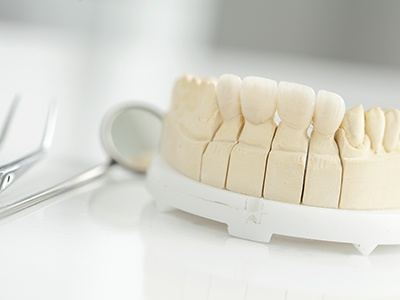 Model of jaw with dental bridge resting on table