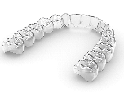 A 3D image of an Invisalign clear aligner