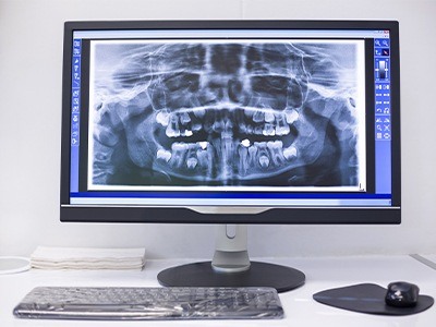 digital x-ray on desktop