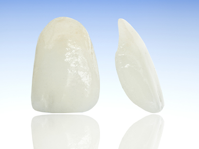 illustrated veneers