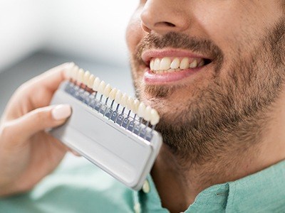 shade chart in fron of man's smile