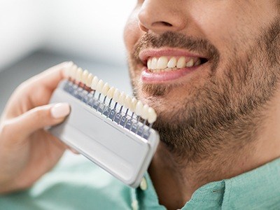 Shade chart in front of smile of dental patient