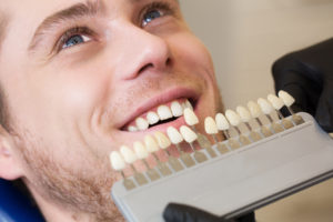 Young man's teeth compared to tooth color chart