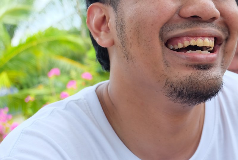 A man with severe tooth stains