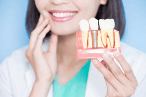 Dentist holding a model of teeth with a dental implant
